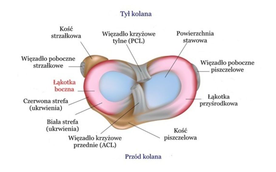 Uszkodzenie (uraz, pęknięcie) łąkotki bocznej – objawy, operacja, leczenie, rehabilitacja