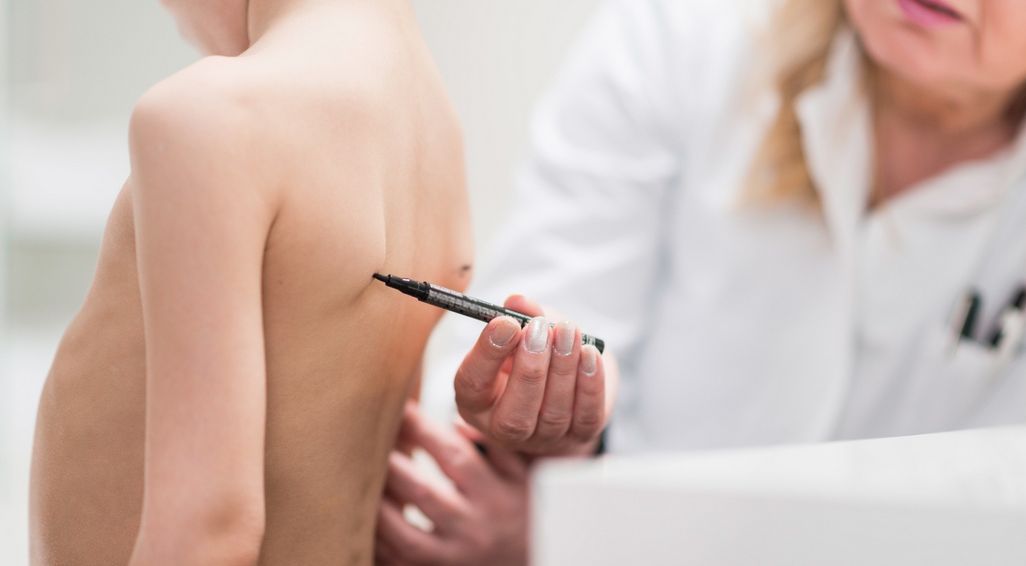 Odstające łopatki u dzieci – ćwiczenia, rehabilitacja
