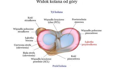 Uszkodzenie (Uraz, Pęknięcie) Łąkotki przyśrodkowej – Objawy, Operacja, Leczenie, Rehabilitacja